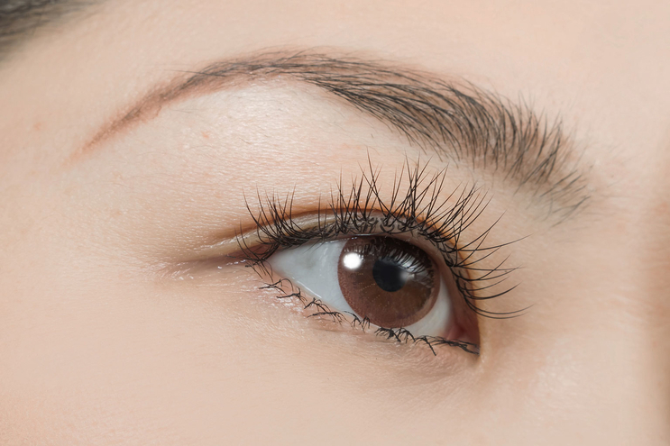 Thick Double Eyelid Reduction