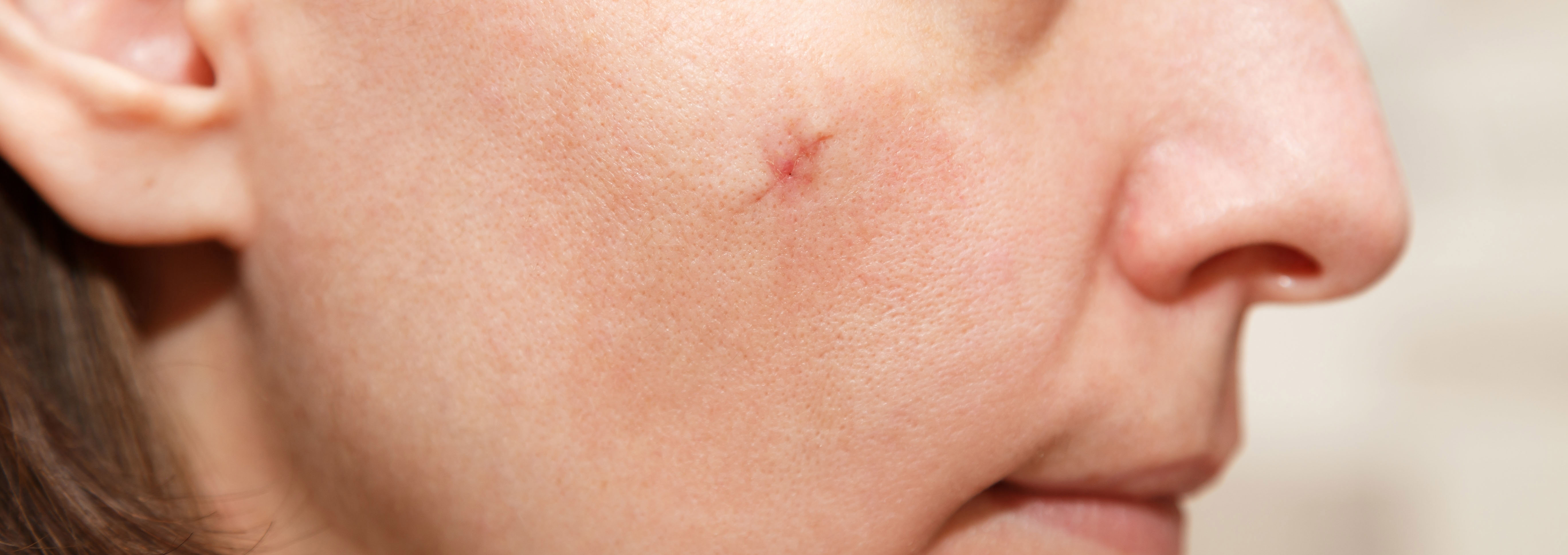 Gangnamseoyon Plastic Surgery