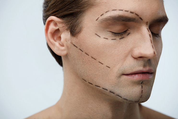 Lifting & Skin Tightening for Men