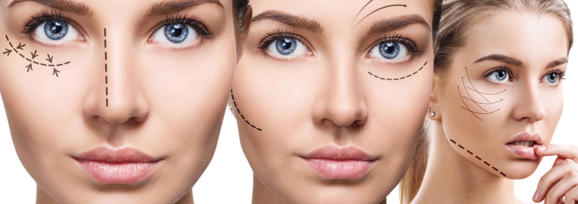 Gangnamseoyon Plastic Surgery