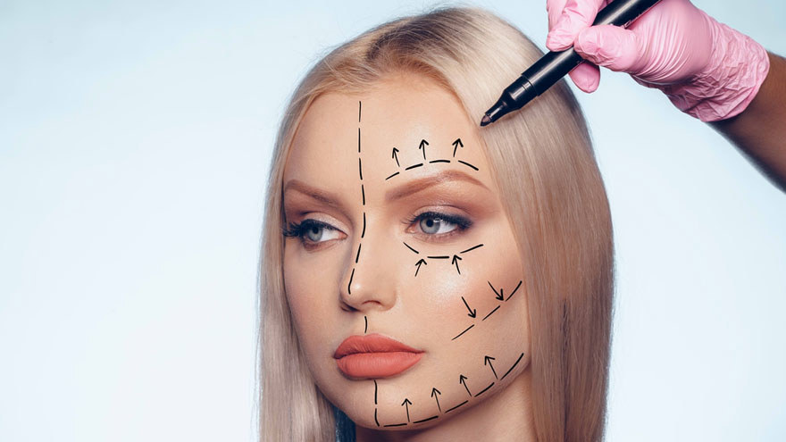 Correction in Eyelid Surgery