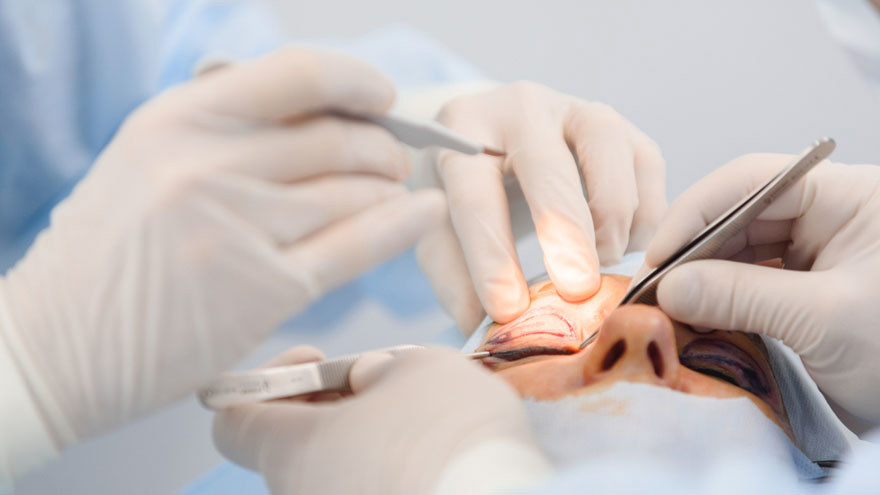 Is Eyelid Surgery Painful?